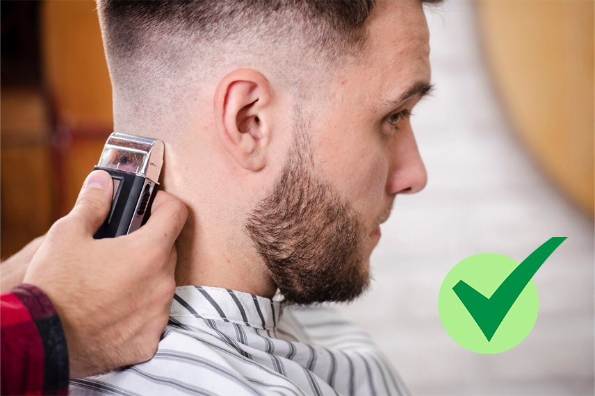 کاشت مو بدون تراشیدن سر ایا برای کاشت مو باید کچل کرد؟