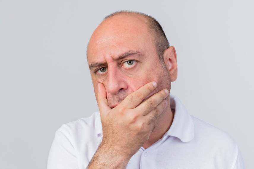 ورم بعد از کاشت مو ورم بعد از کاشت مو